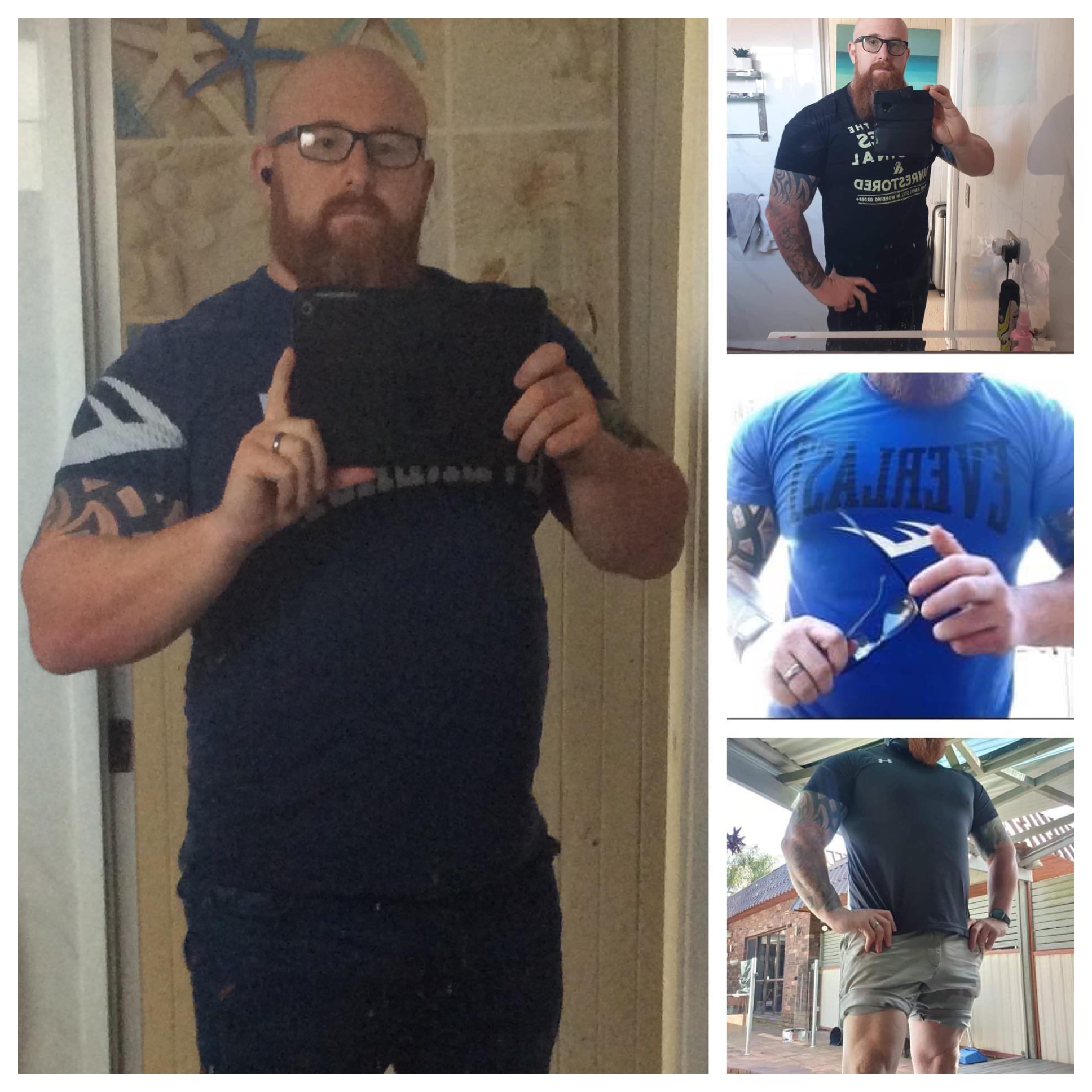 6 feet 1 Male Before and After 70 lbs Weight Loss 330 lbs to 260 lbs