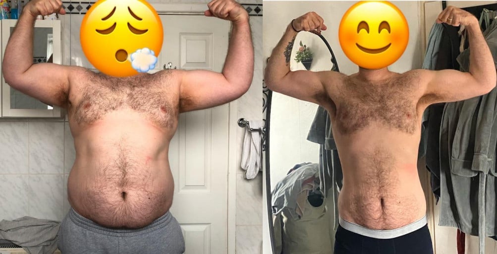 6 foot 2 Male Before and After 103 lbs Weight Loss 310 lbs to 207 lbs