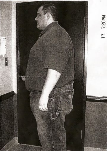 A before and after photo of a 6'3" male showing a weight reduction from 450 pounds to 250 pounds. A net loss of 200 pounds.
