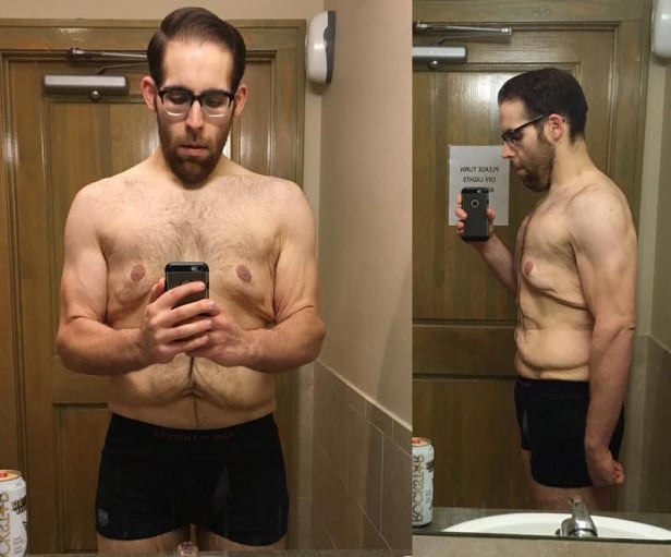 A progress pic of a 6'0" man showing a weight cut from 506 pounds to 206 pounds. A respectable loss of 300 pounds.