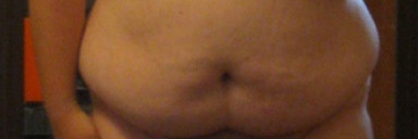 5 foot 10 Male 141 lbs Fat Loss 340 lbs to 199 lbs