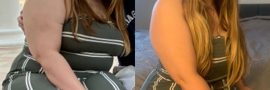 Before and After 34 lbs Weight Loss 5'2 Female 243 lbs to 209 lbs