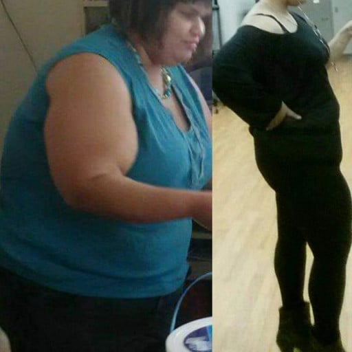 A photo of a 5'4" woman showing a weight cut from 400 pounds to 200 pounds. A net loss of 200 pounds.