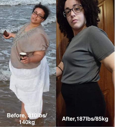 A before and after photo of a 5'8" female showing a weight reduction from 310 pounds to 187 pounds. A total loss of 123 pounds.