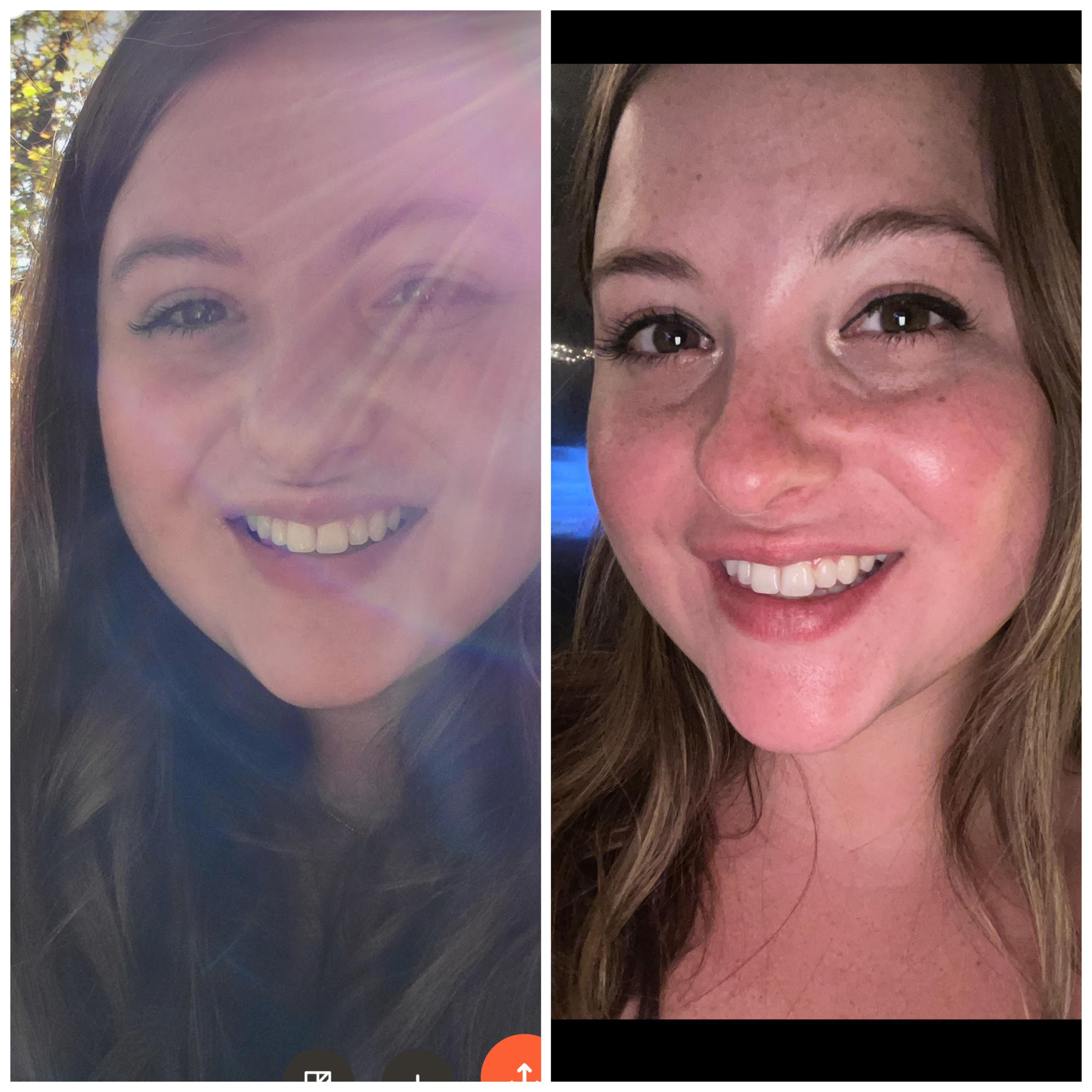 41 lbs Fat Loss Before and After 5 foot 9 Female 270 lbs to 229 lbs
