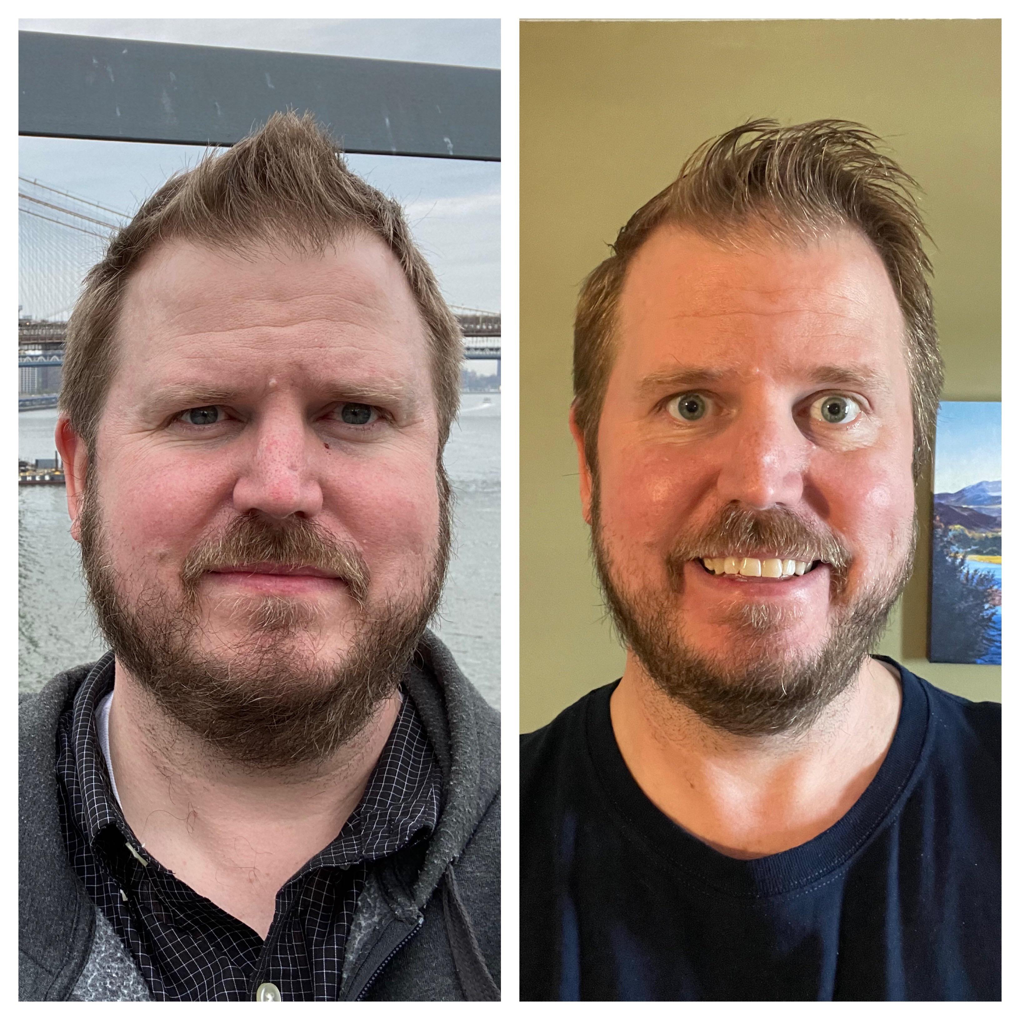 50 lbs Weight Loss 6 feet 5 Male 358 lbs to 308 lbs