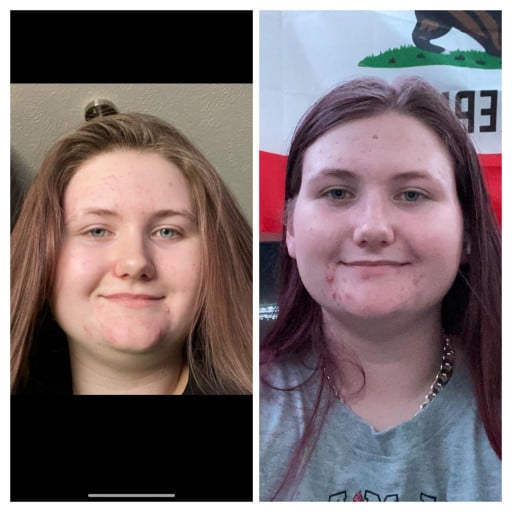F/18/5’10 [221>200=21lb 5 Months] Started Keto a few months ago and feeling so much better after seeing my face gains!
