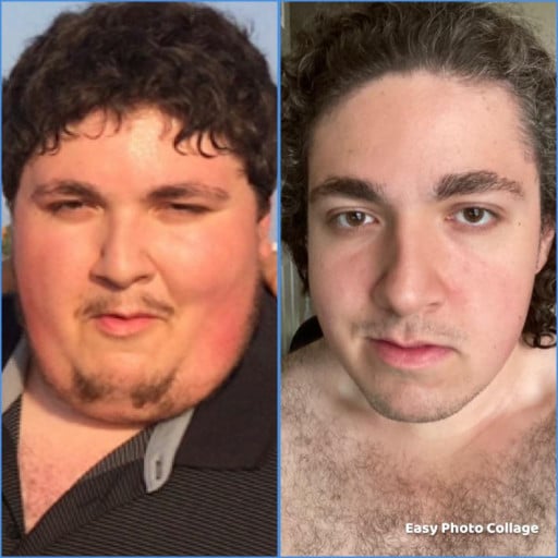 A picture of a 6'2" male showing a weight loss from 450 pounds to 278 pounds. A respectable loss of 172 pounds.