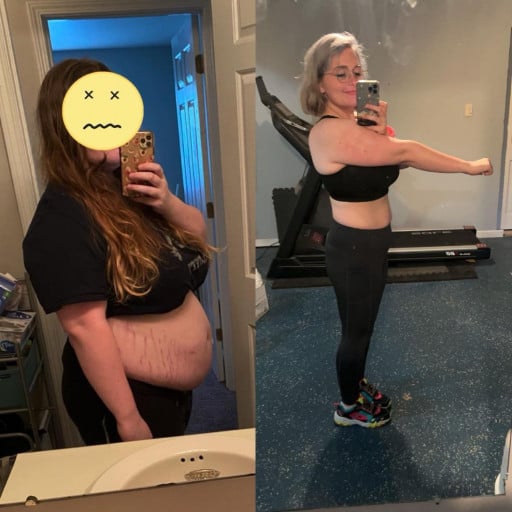A before and after photo of a 5'7" female showing a weight reduction from 296 pounds to 172 pounds. A respectable loss of 124 pounds.