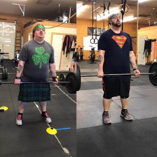 A before and after photo of a 6'0" male showing a weight reduction from 393 pounds to 318 pounds. A total loss of 75 pounds.