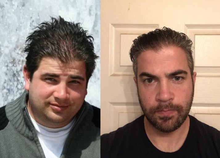 6 feet 2 Male 53 lbs Fat Loss Before and After 290 lbs to 237 lbs