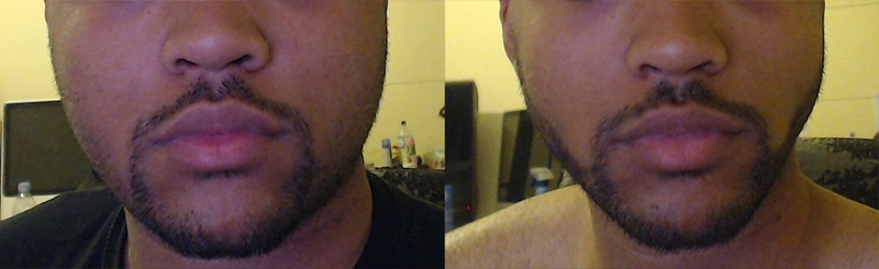Before and After 45 lbs Weight Loss 5 feet 10 Male 217 lbs to 172 lbs