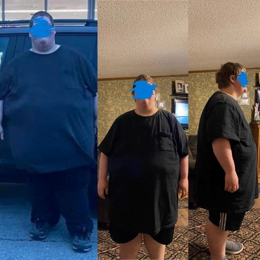 A before and after photo of a 5'7" male showing a weight reduction from 564 pounds to 381 pounds. A net loss of 183 pounds.