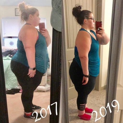 A before and after photo of a 5'3" female showing a weight reduction from 400 pounds to 296 pounds. A respectable loss of 104 pounds.