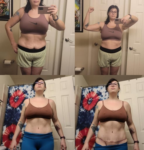 A before and after photo of a 5'6" female showing a weight reduction from 175 pounds to 100 pounds. A net loss of 75 pounds.
