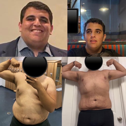A before and after photo of a 6'3" male showing a weight reduction from 365 pounds to 290 pounds. A net loss of 75 pounds.