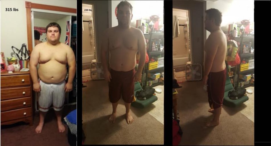 76 lbs Weight Loss Before and After 5 feet 8 Male 315 lbs to 239 lbs