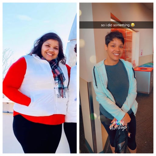 130 lbs Weight Loss Before and After 5 feet 7 Female 328 lbs to 198 lbs
