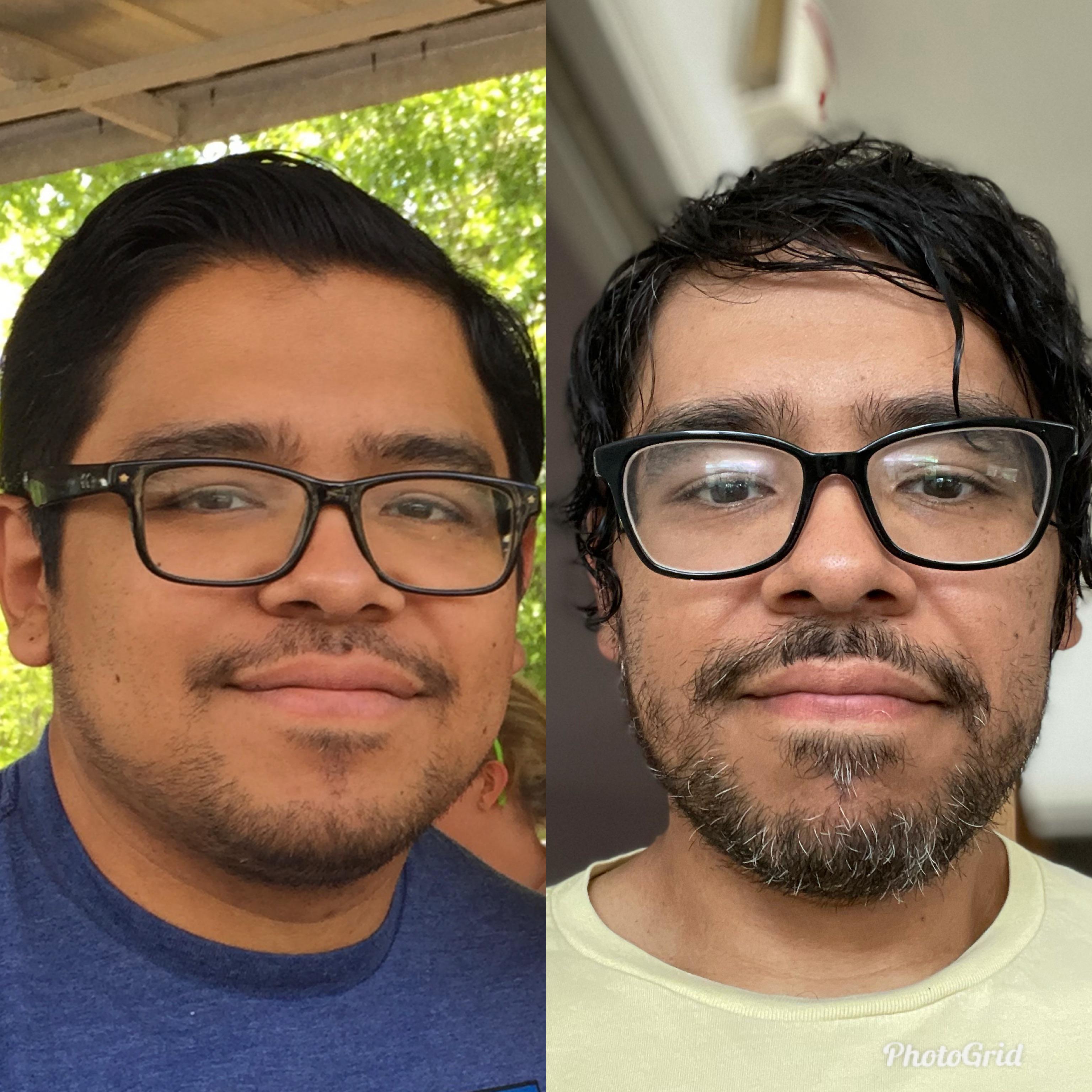 5'6 Male Progress Pics of 48 lbs Fat Loss 218 lbs to 170 lbs