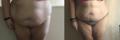 Progress Pics of 112 lbs Weight Loss 5 foot 5 Female 347 lbs to 235 lbs