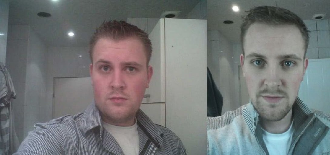 A before and after photo of a 6'3" male showing a weight loss from 250 pounds to 188 pounds. A net loss of 62 pounds.