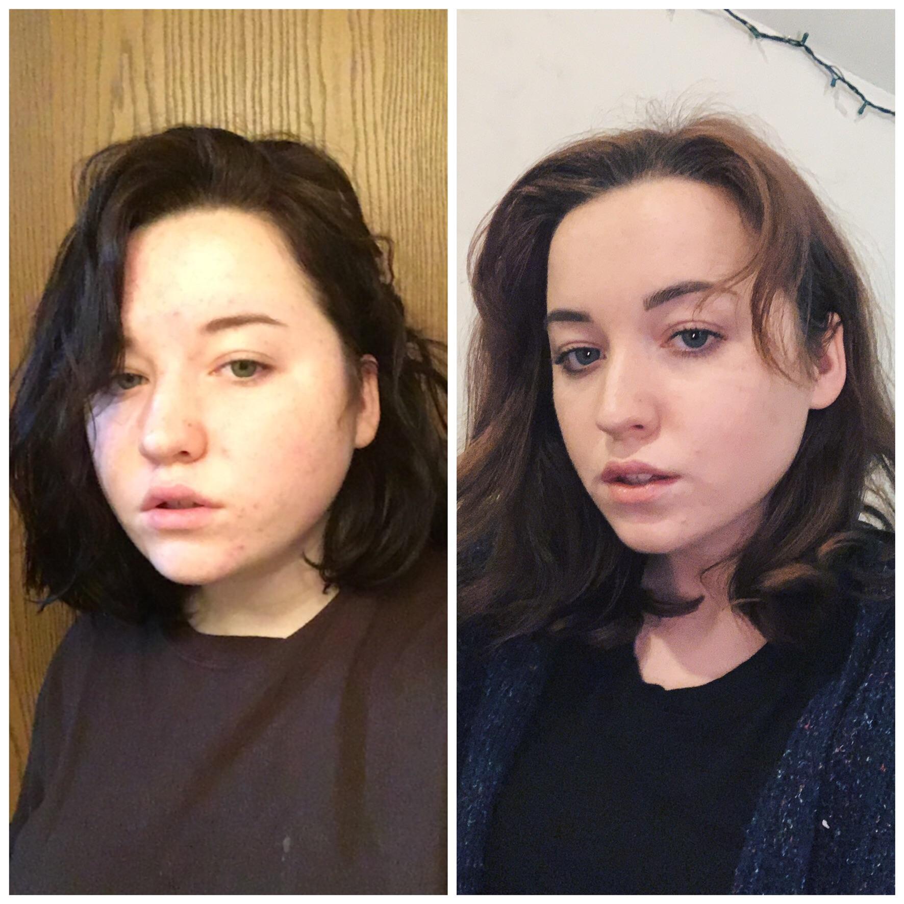 69 lbs Weight Loss 5'7 Female 194 lbs to 125 lbs