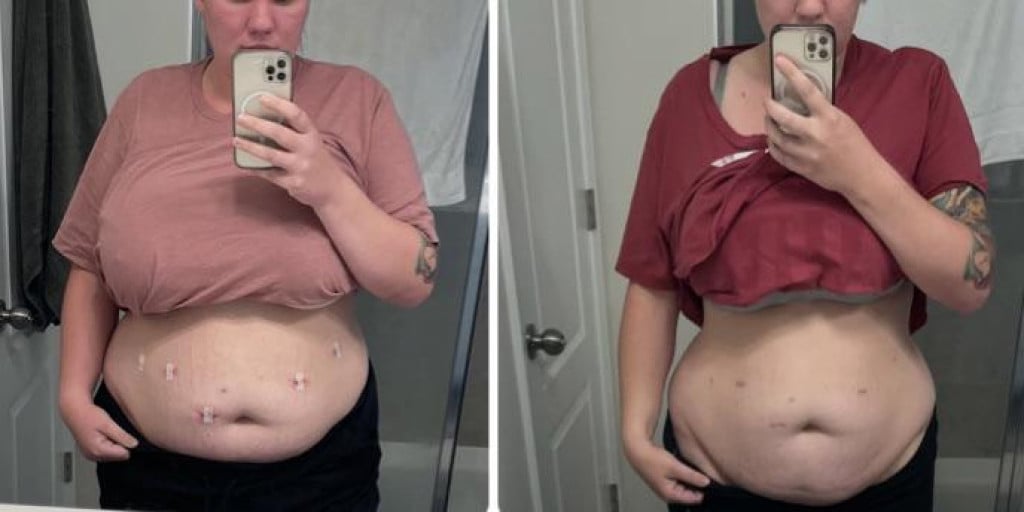 A progress pic of a 5'7" woman showing a fat loss from 257 pounds to 205 pounds. A net loss of 52 pounds.