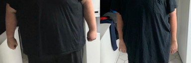 414 lbs Weight Loss 6 feet 8 Male 764 lbs to 350 lbs