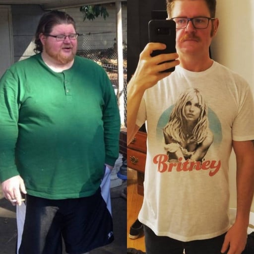 6 foot Male 170 lbs Weight Loss Before and After 360 lbs to 190 lbs