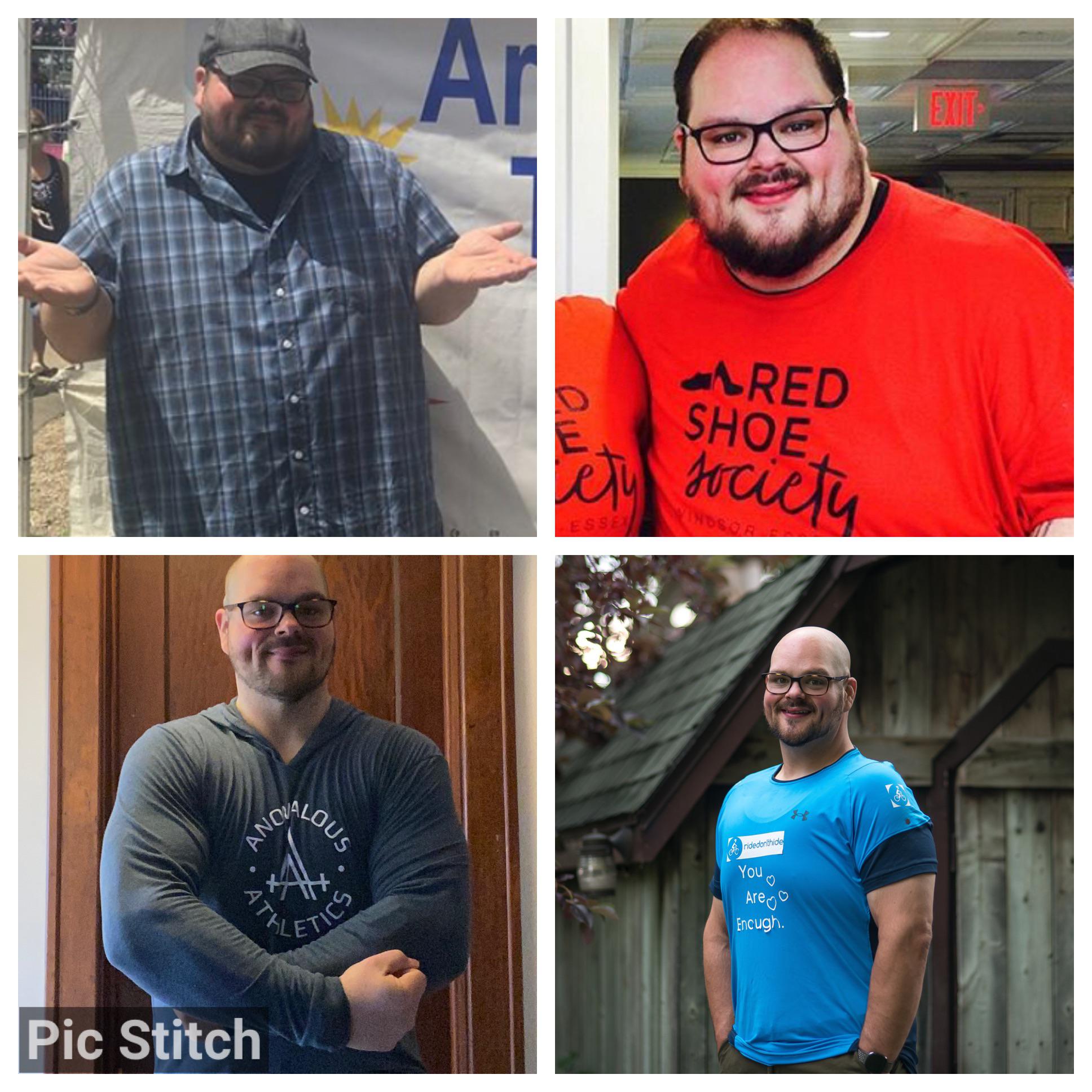 Progress Pics of 170 lbs Weight Loss 5'10 Male 400 lbs to 230 lbs