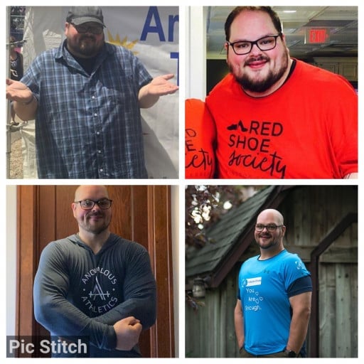 A picture of a 5'10" male showing a weight loss from 400 pounds to 230 pounds. A net loss of 170 pounds.