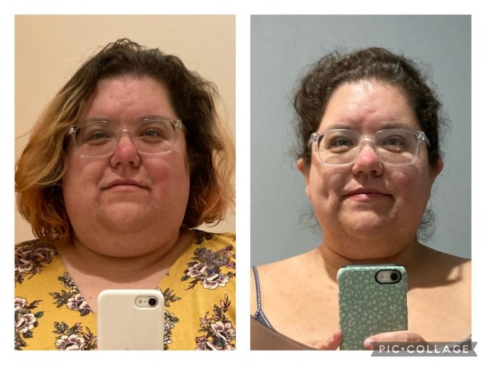 A before and after photo of a 5'3" female showing a weight reduction from 430 pounds to 311 pounds. A net loss of 119 pounds.