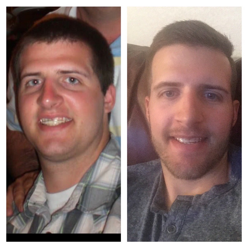 Before and After 63 lbs Weight Loss 6 feet 1 Male 253 lbs to 190 lbs
