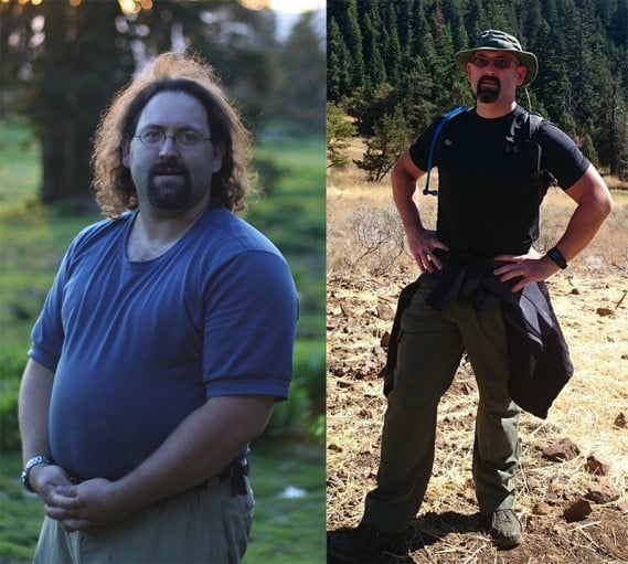 A before and after photo of a 5'11" male showing a weight reduction from 285 pounds to 215 pounds. A net loss of 70 pounds.