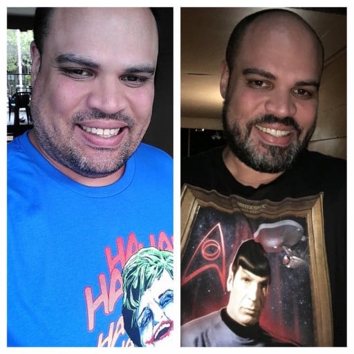 A before and after photo of a 6'4" male showing a weight reduction from 400 pounds to 312 pounds. A net loss of 88 pounds.