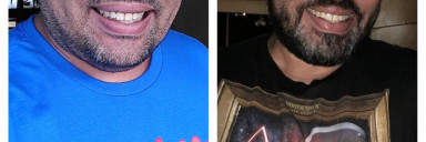 88 lbs Weight Loss Before and After 6 feet 4 Male 400 lbs to 312 lbs