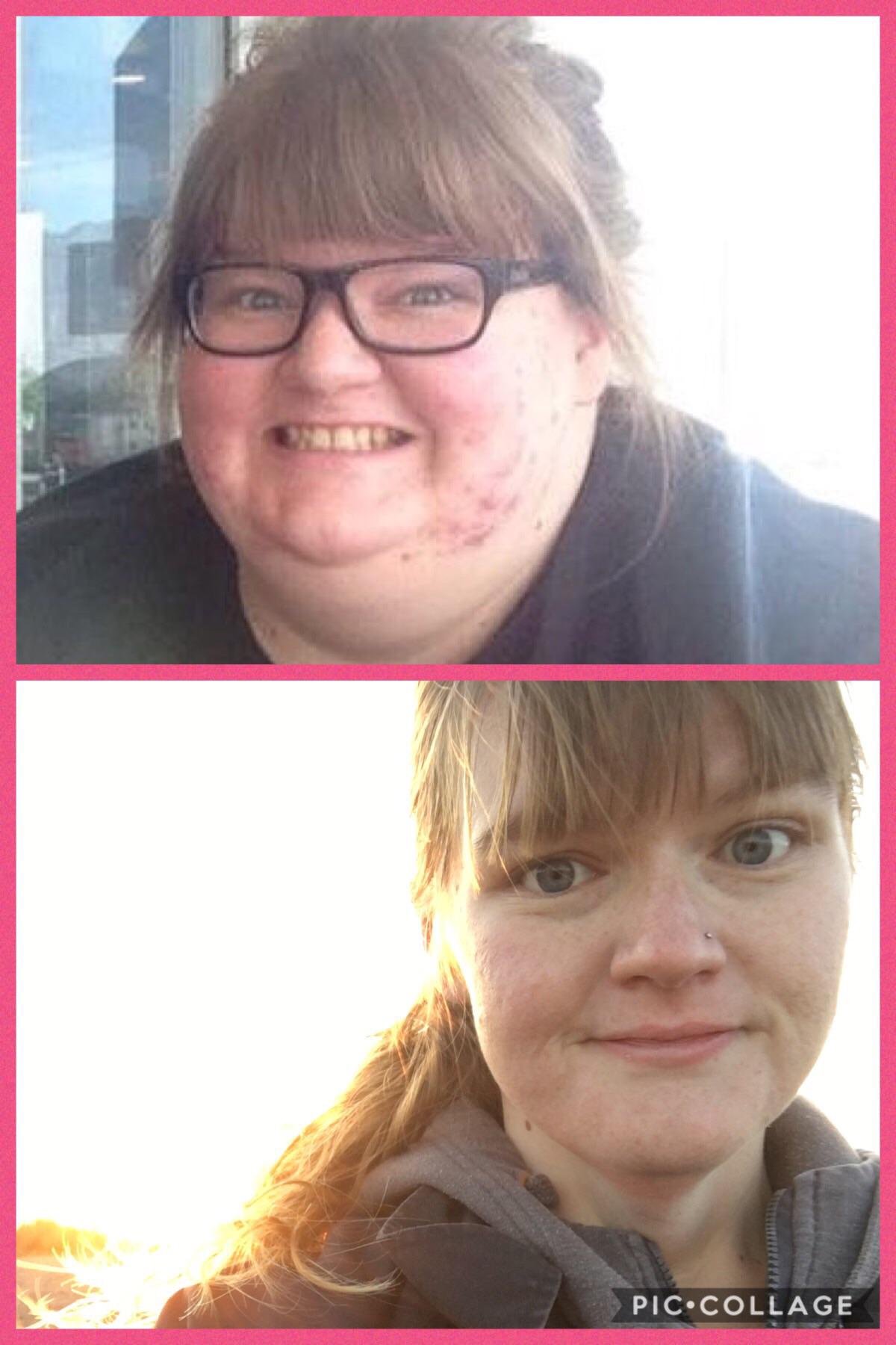 203 lbs Weight Loss Before and After 5'6 Female 425 lbs to 222 lbs