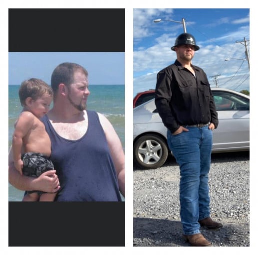 A picture of a 5'11" male showing a weight loss from 420 pounds to 258 pounds. A total loss of 162 pounds.