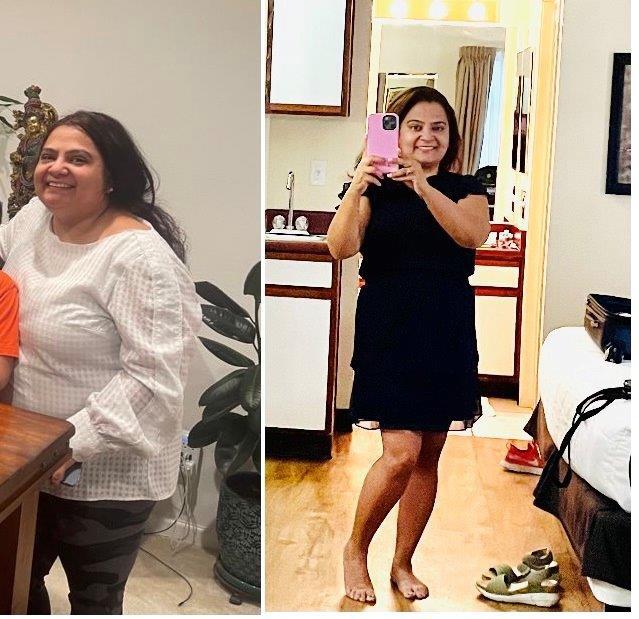 45 lbs Weight Loss Before and After 5 feet 1 Female 189 lbs to 144 lbs