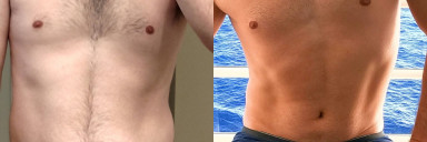 Progress Pics of 32 lbs Fat Loss 5 foot 9 Male 202 lbs to 170 lbs