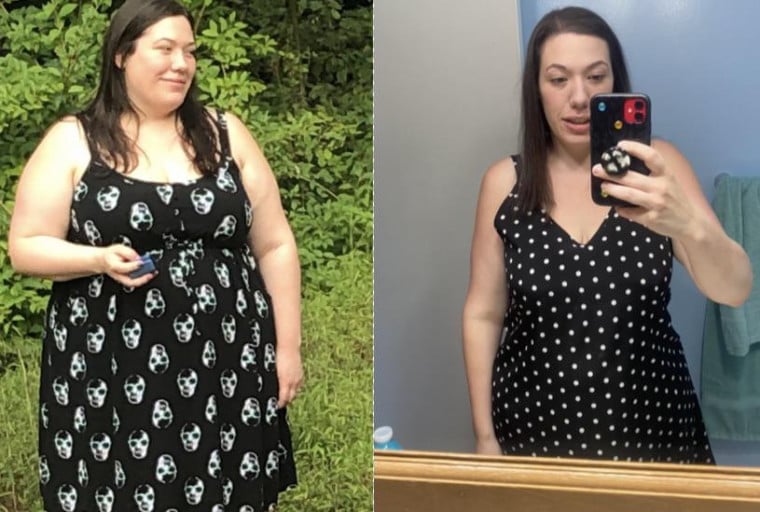 A picture of a 5'3" female showing a weight loss from 301 pounds to 174 pounds. A total loss of 127 pounds.