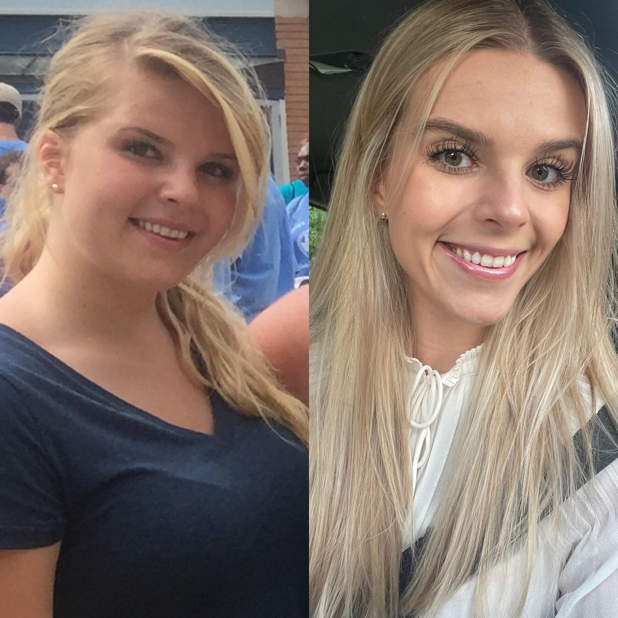 5 foot 9 Female 66 lbs Weight Loss 199 lbs to 133 lbs
