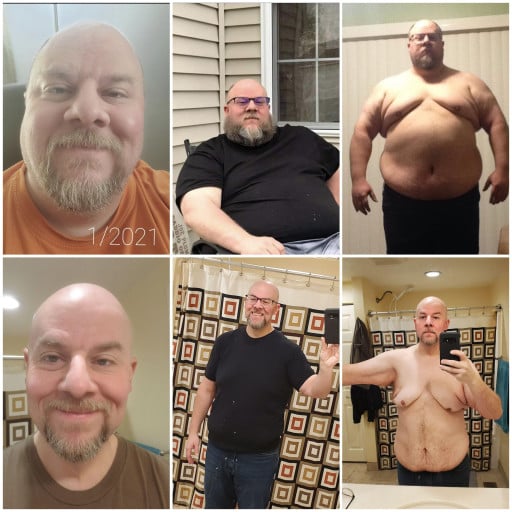 A before and after photo of a 5'11" male showing a weight reduction from 402 pounds to 228 pounds. A total loss of 174 pounds.