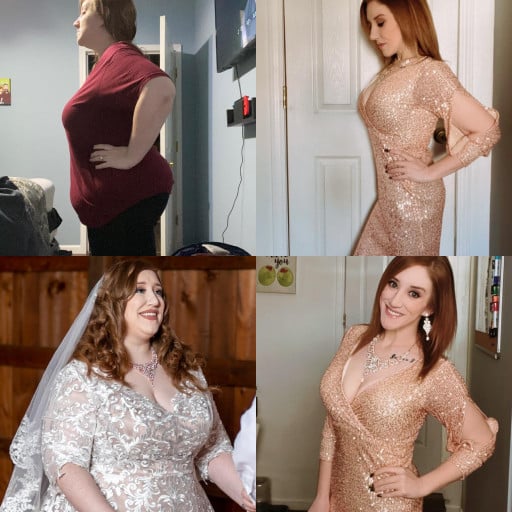 A picture of a 5'4" female showing a weight loss from 284 pounds to 122 pounds. A total loss of 162 pounds.
