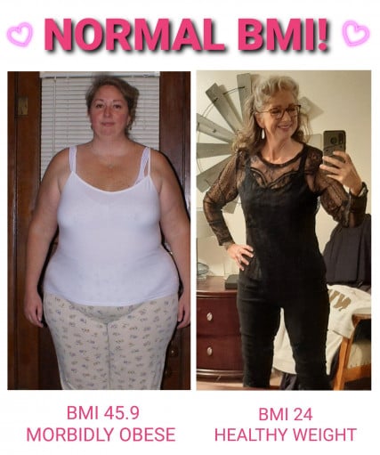 A before and after photo of a 5'11" female showing a weight reduction from 329 pounds to 171 pounds. A respectable loss of 158 pounds.