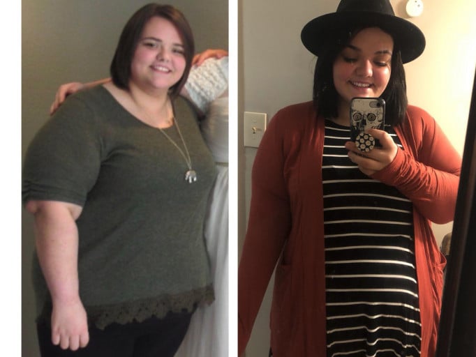 5'7 Female 70 lbs Weight Loss Before and After 340 lbs to 270 lbs