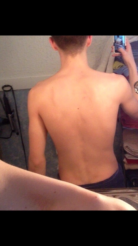 Progress Pics of 18 lbs Weight Gain 5'10 Male 128 lbs to 146 lbs