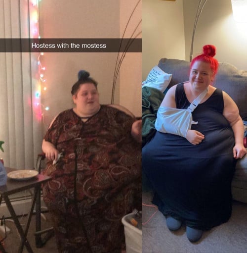 A progress pic of a 5'5" woman showing a fat loss from 520 pounds to 344 pounds. A respectable loss of 176 pounds.