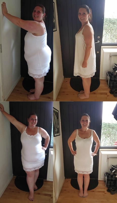 Before and After 156 lbs Weight Loss 5 foot 8 Female 352 lbs to 196 lbs