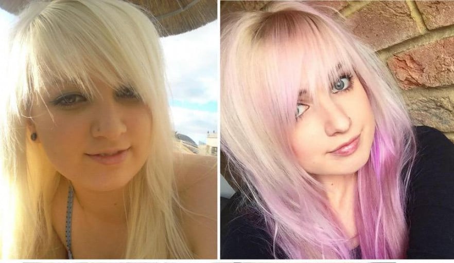 Female in Her Twenties Loses 33 Pounds in Eighteen Months: See Her Face Progress!
